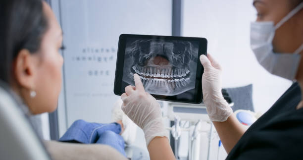 Licensed Teeth Whitening service in Farmington Hills, MI - Smile Center Dentistry